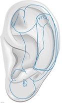 Ωτοβελονισμός - Έμβρυο στο πτερύγιο του αυτιού